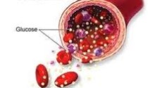 The Prevention and Treatment of Hyperglycemia – High Blood Sugar