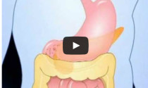What is Diabetes?